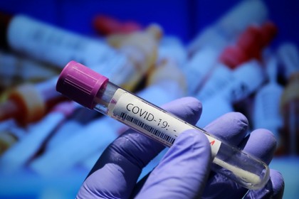 Българските граждани ще влизат в Черна гора с PCR тест, тест за антитела или удостоверение за ваксинация