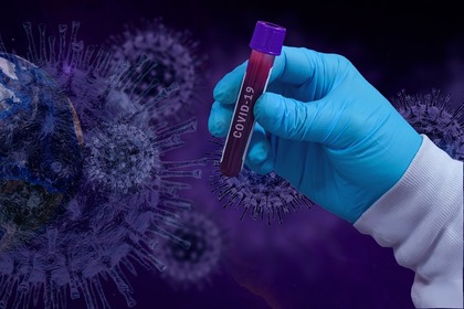 Гърция отмени допълнителното изискване за тест за COVID-19 за ваксинирани и преболедували граждани при влизане в страната